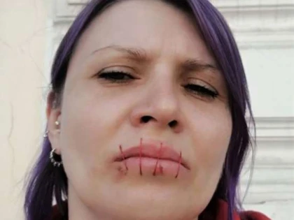O activistă rusă şi-a cusut gura în semn de protest faţă de războiul din Ucraina