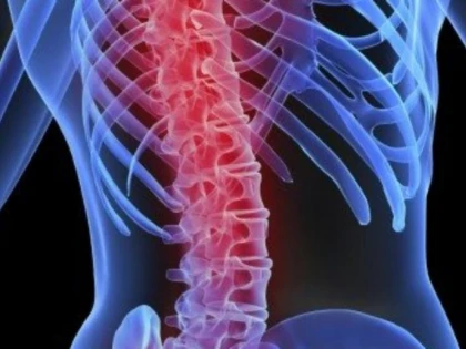 O inovaţie tehnologică dă speranţe pacienţilor care suferă de cancer osos