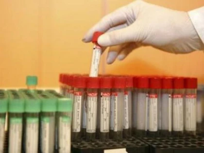 O NOUA TERAPIE ANTI-HIV, REALIZATA CU ANTICORPI NATURALI, OFERA REZULTATE PROMITATOARE