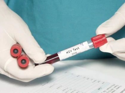 OMENIREA A ATINS AL SASELEA OBIECTIV AL MILENIULUI. CE SE VA INTAMPLA CU VIRUSUL HIV PANA IN 2030