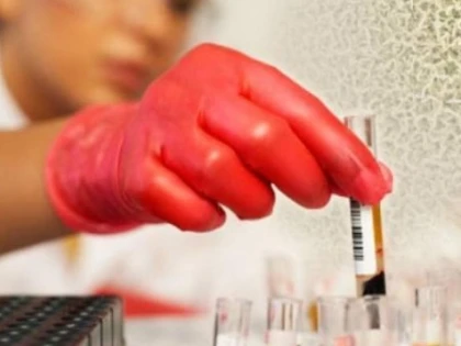 Peste 100.000 de români sunt diagnosticați anual cu cancer