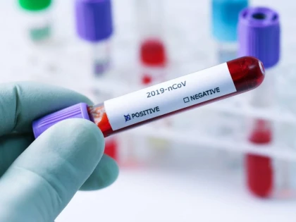 Rata de infectare scade, dar creşte numărul de morţi