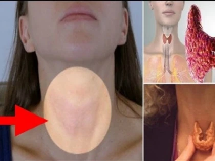 Remediul natural care ”repornește” tiroida