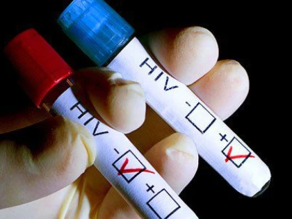 Șase ani de închisoare pentru un arădean care a infectat intenționat o minoră cu virusul HIV