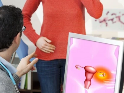 Testele pentru depistarea cancerului ovarian