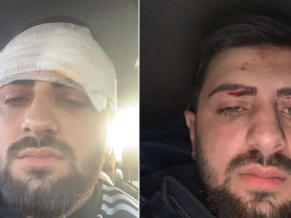 Tineri răpiţi, încătuşaţi şi bătuţi de 6 indivizi, la Ghioroc! Un important lider TNL Arad, acuzat că ar fi printre agresori