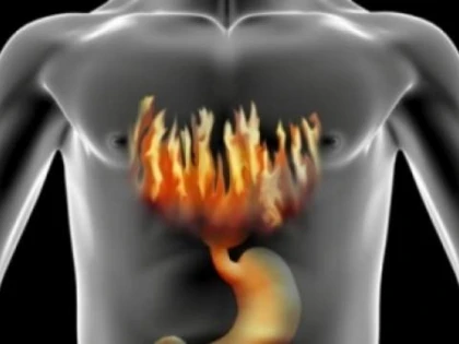 Top 5 cele mai eficiente remedii naturale pentru refluxul gastric