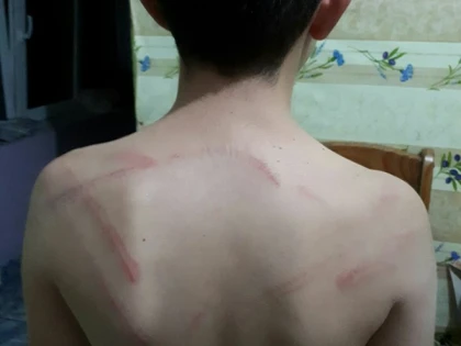 Un copil de 9 ani a fost bătut cu sălbăticie de tatăl său. Bărbatul a ajuns în arestul IPJ Arad