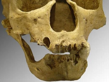 UN MAXILAR UMAN DESCOPERIT IN ROMANIA, LA BAZA UNUI STUDIU IMPORTANT DESPRE OMUL DE NEANDERTHAL