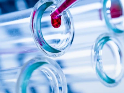 Un nou test de sânge ar putea depista cancerul cu patru ani înainte ca simptomele să apară