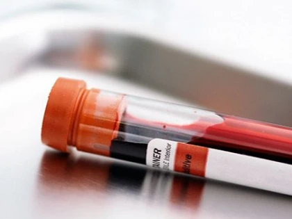 UN TRATAMENT EXPERIMENTAL A VINDECAT COMPLET UN PACIENT INFECTAT CU HIV