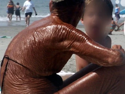 Unde poate duce obsesia de a avea permanent pielea bronzată