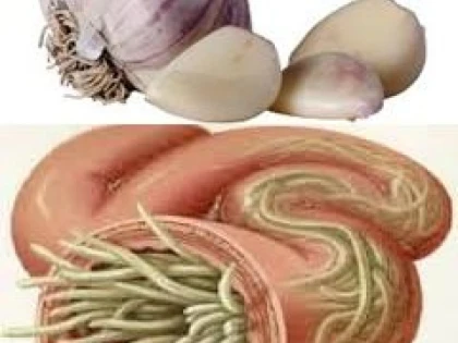 USTUROIUL AJUTA LA ELIMINAREA PARAZITILOR INTESTINALI
